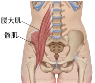 【康医科普】大腿根部疼痛 小心髂腰肌综合症