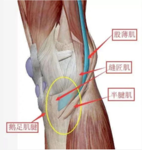 【康医科普】膝盖内侧痛？小心鹅足肌腱炎